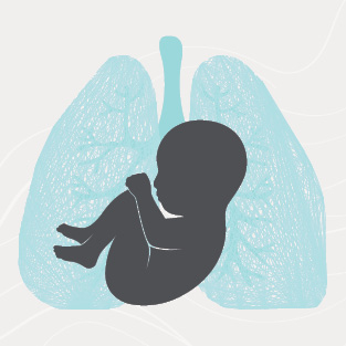 Stanford Bronchopulmonary Dysplasia (BPD) Research Symposium Banner